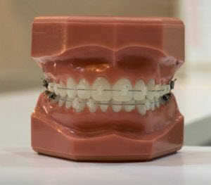 All I Want Is My Three Front Teeth – by Art Fettig